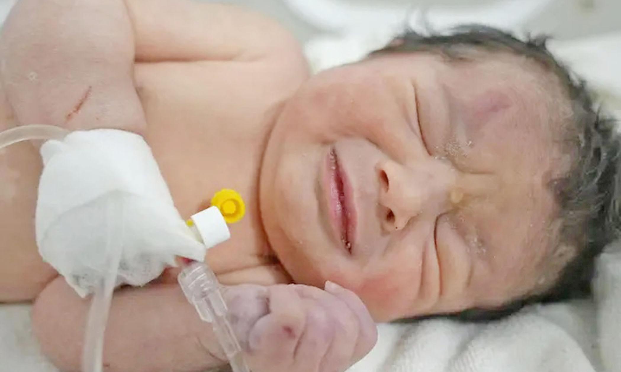 நொறுங்கிய ஆஸ்பத்திரிக்குள் தொப்புள் கொடி அறுக்கப்படாத நிலையில் உயிருடன் மீட்கப்பட்ட பச்சிளம் குழந்தை மீட்பு